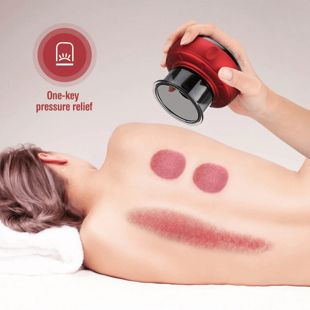 Smart Vacuum Cupping Device